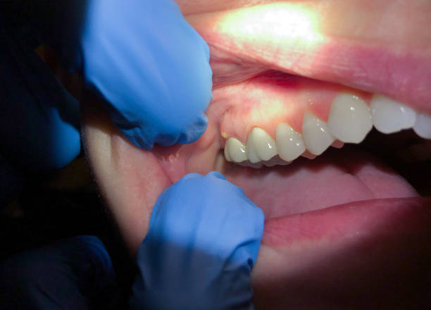 Canal Winchester, OH Emergency Dentist Pros